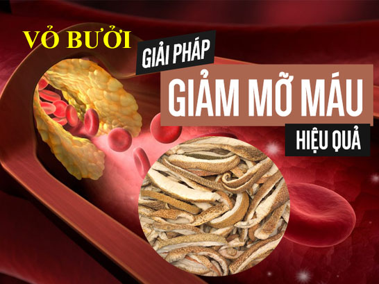 thuốc nam chữa bệnh mỡ máu cao thuốc nam chữa bệnh mỡ máu cao