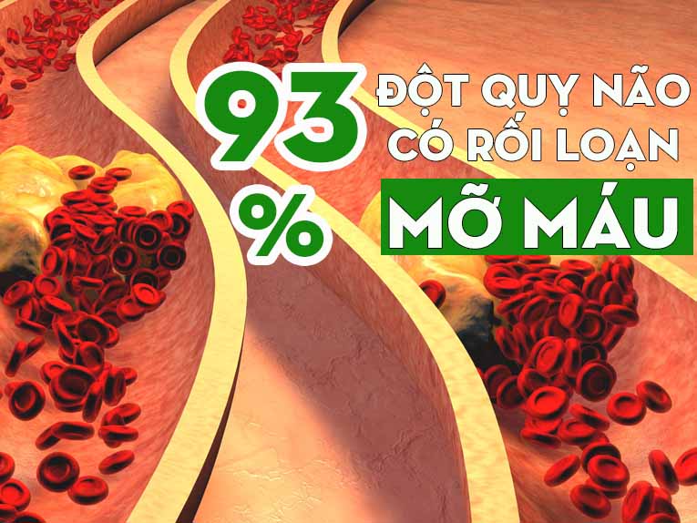 Bệnh mỡ máu cao Bệnh mỡ máu cao