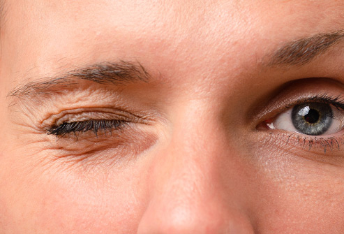 Mắt phải giật, nháy liên tục: Điềm báo xấu hay bệnh lý về mắt?